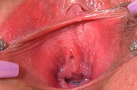Free Access Gape My Pussy s0